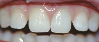 Лечение зубов в первом меде