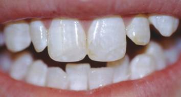 Лечение зубов в первом меде
