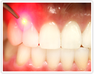 Зубы, физиотерапия в стоматологии