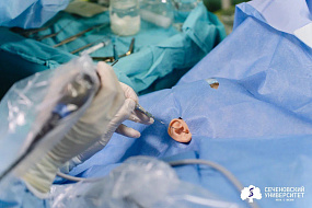 В Сеченовском Университете запустили уникальные операции по восстановлению барабанной перепонки из собственных клеток пациента