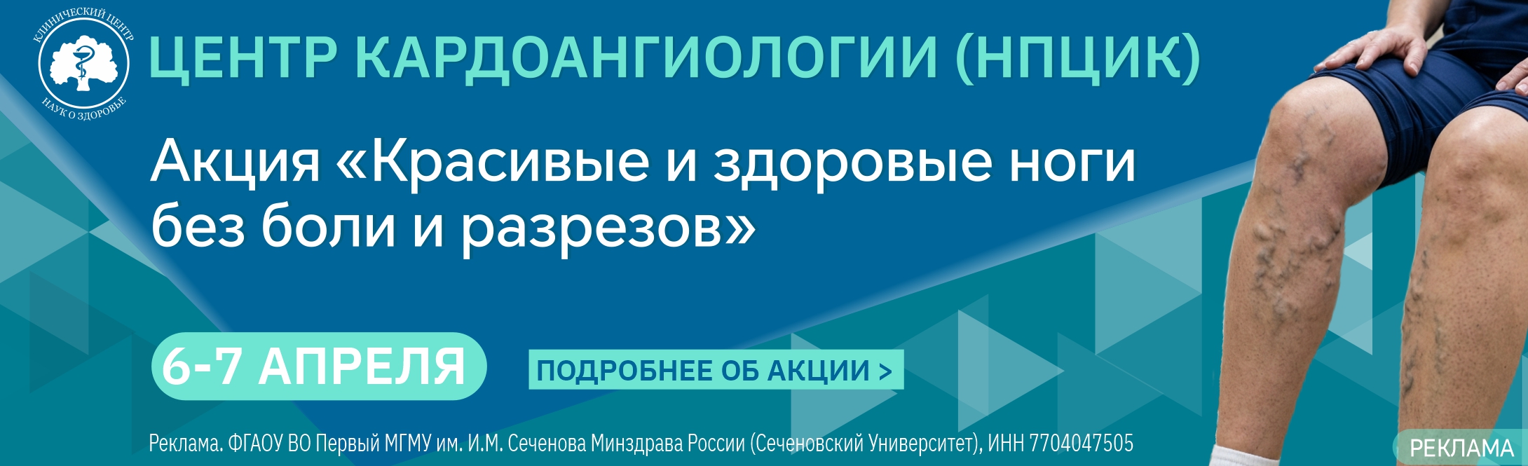 ДОД Варикоз