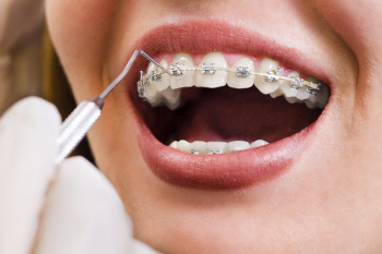 30 сентября - День ортодонта
