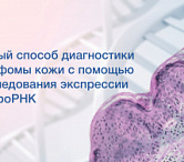 Директор Клиники кожных и венерических заболеваний имени В.А. Рахманова Ольга Олисова рассказала о новом способе диагностировать лимфомы кожи с помощью исследования экспрессии микроРНК