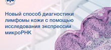 Директор Клиники кожных и венерических заболеваний имени В.А. Рахманова Ольга Олисова рассказала о новом способе диагностировать лимфомы кожи с помощью исследования экспрессии микроРНК